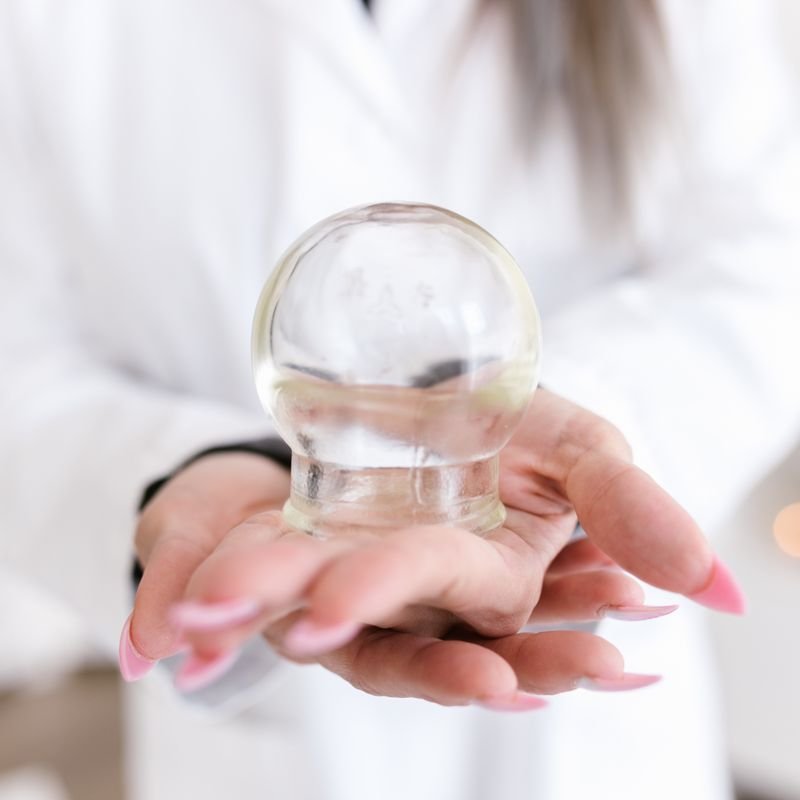 Hijama (Cupping)